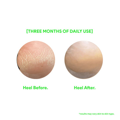 The Foot Repair & Brightening Cream with Lactic Acid